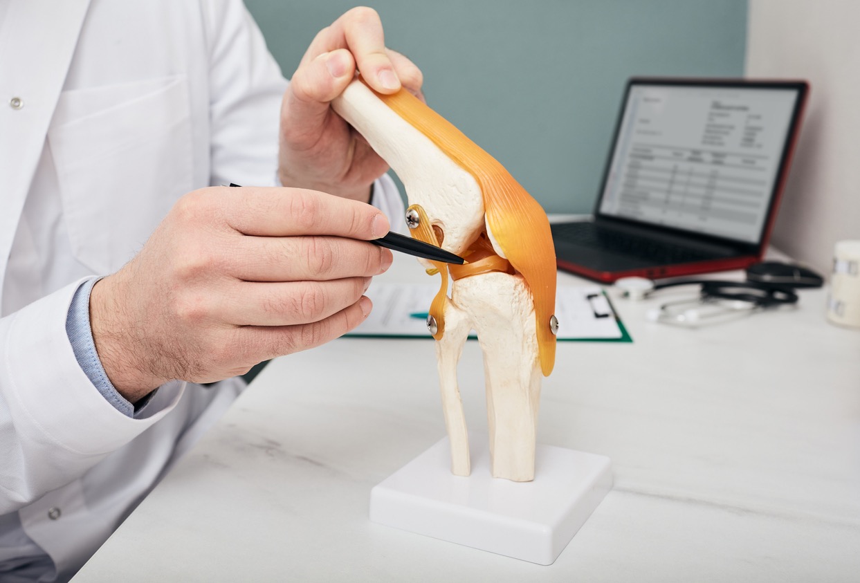 Knieprothese - anatomisch model van kniegewricht