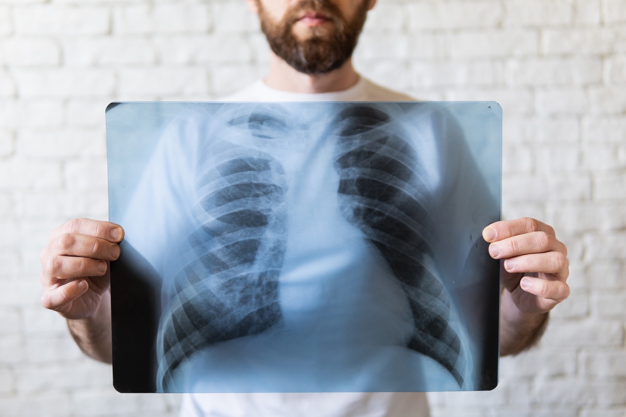 Long fysiotherapie behandeling
