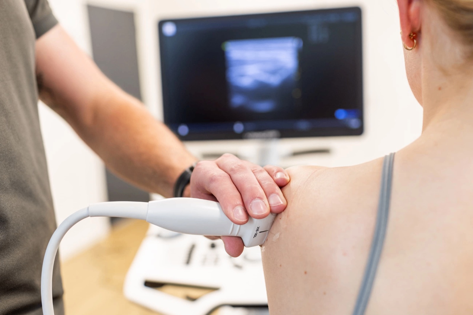 Echografie onderzoek bij schouderverkalking